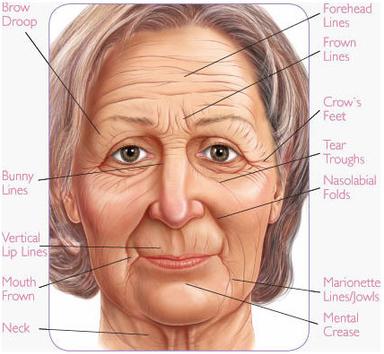 wrinkle